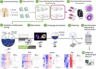Use of high-plex data provides novel insights into the temporal artery processes of giant cell arteritis